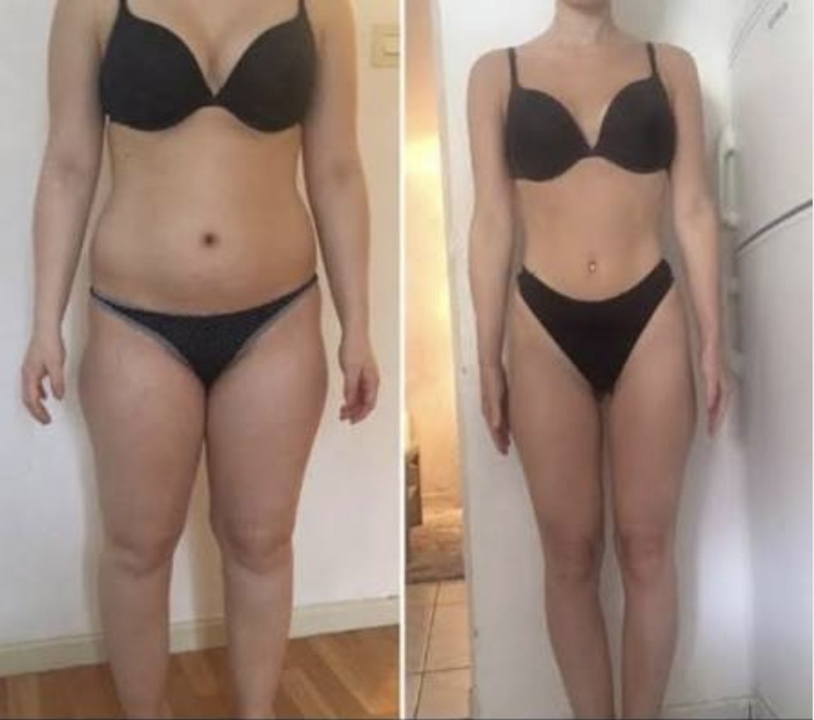 Photo avant/après d'une cliente ayant suivi une cure LavaSlim